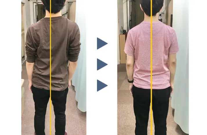 田上理論式 ギックリ腰最短定型的施術法 田上理論式 ギックリ腰最短定型的施術法